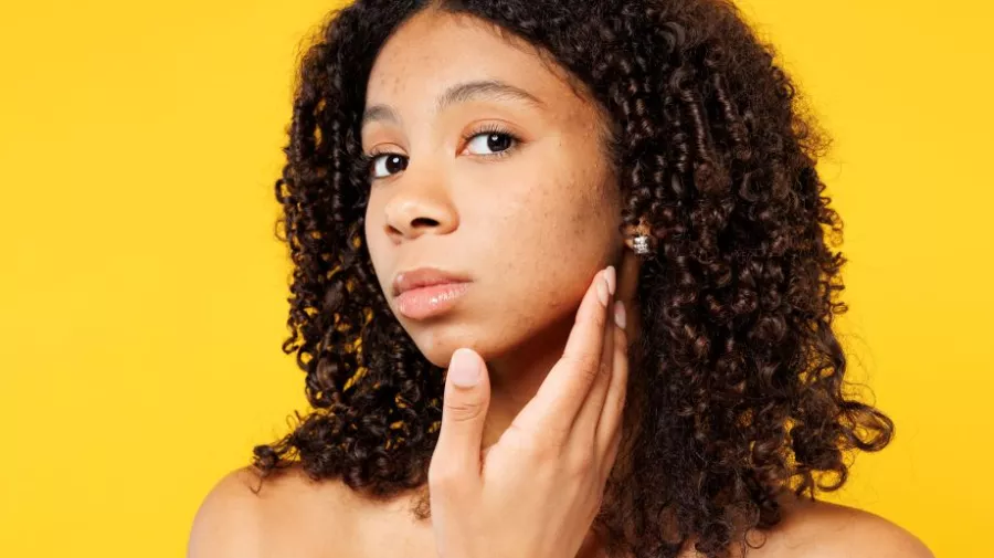 young girl touching her face